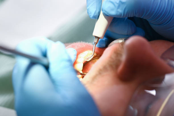 Best Emergency Denture Repair in Hamilton College, NY